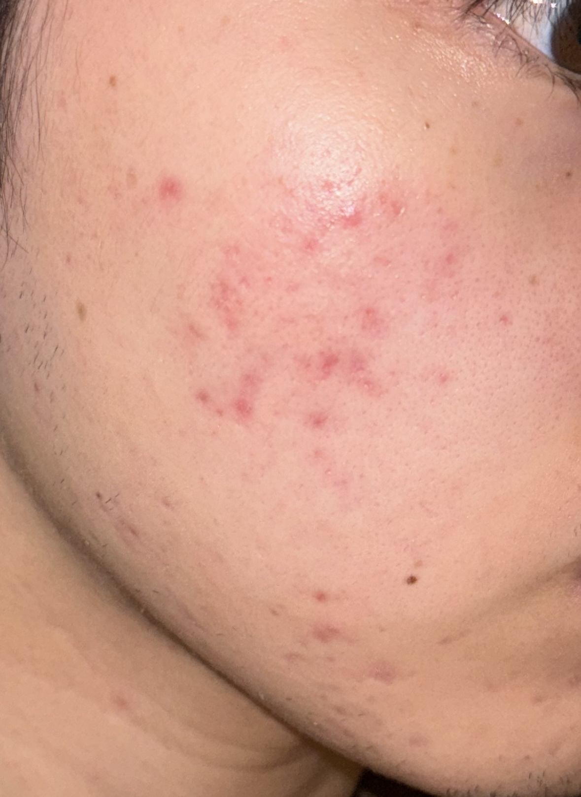 グリーンティー　ヒアルロン　スキン/innisfree/化粧水を使ったクチコミ（1枚目）