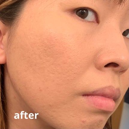 èæœ€ããã«ãCCã¯ãªãŒã /ç±³è/CCã¯ãªãŒã ã䜿ã£ãã¯ãã³ãïŒ8æç®ïŒ