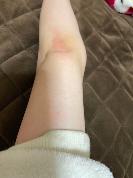 二の腕ザラザラを洗う重曹石けん/ペリカン石鹸/ボディ石鹸を使ったクチコミ(2枚目)