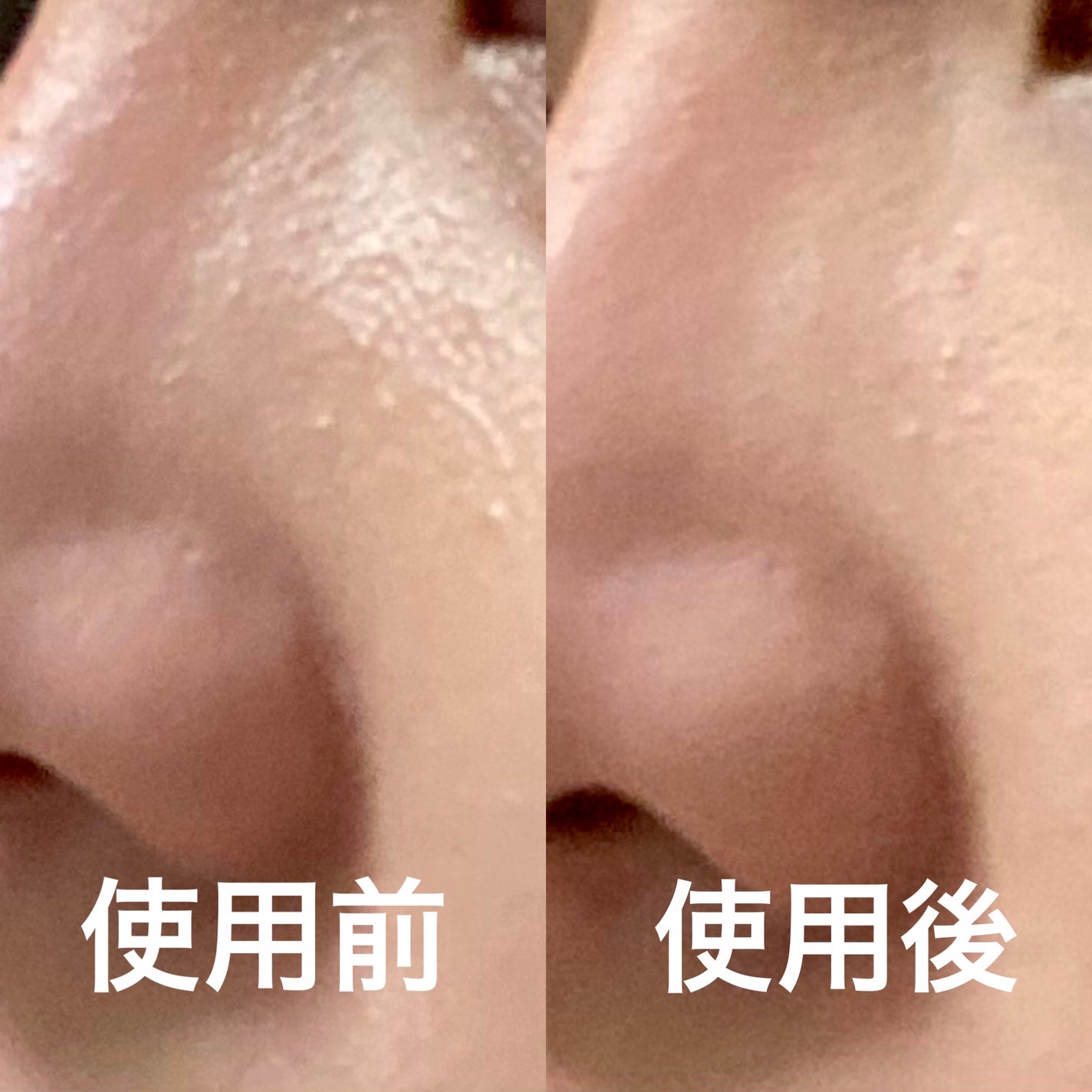 ミネラルルースパウダー/aZTK/ルースパウダーを使ったクチコミ(4枚目)