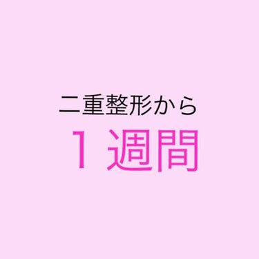 ⚠️目のBefore Afterの写真あります。


＿＿＿＿＿＿＿＿＿＿＿＿＿＿＿＿＿＿＿＿＿
大体、１週間で腫れの7割が落ち着くらしいです

もう、１週間たったことに驚きました😂😂

今はいつ鏡を見