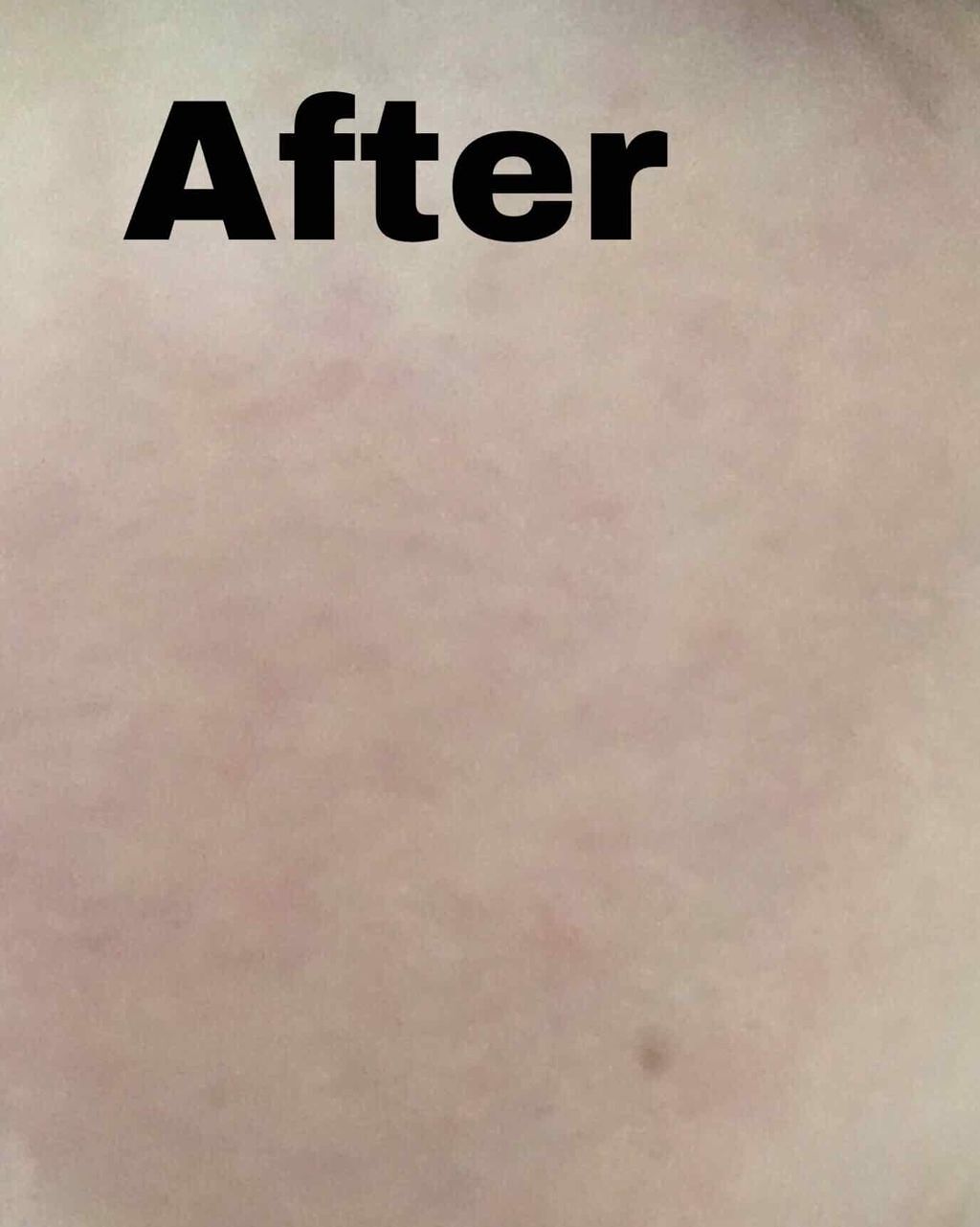 ドクタージャルト シカペア リカバー (第2世代)/Dr.Jart+/フェイスクリームを使ったクチコミ(4枚目)