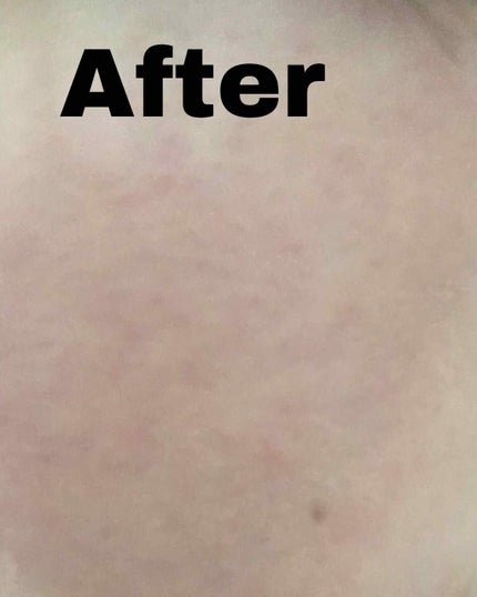 ドクタージャルト シカペア リカバー (第2世代)/Dr.Jart+/フェイスクリームを使ったクチコミ(4枚目)