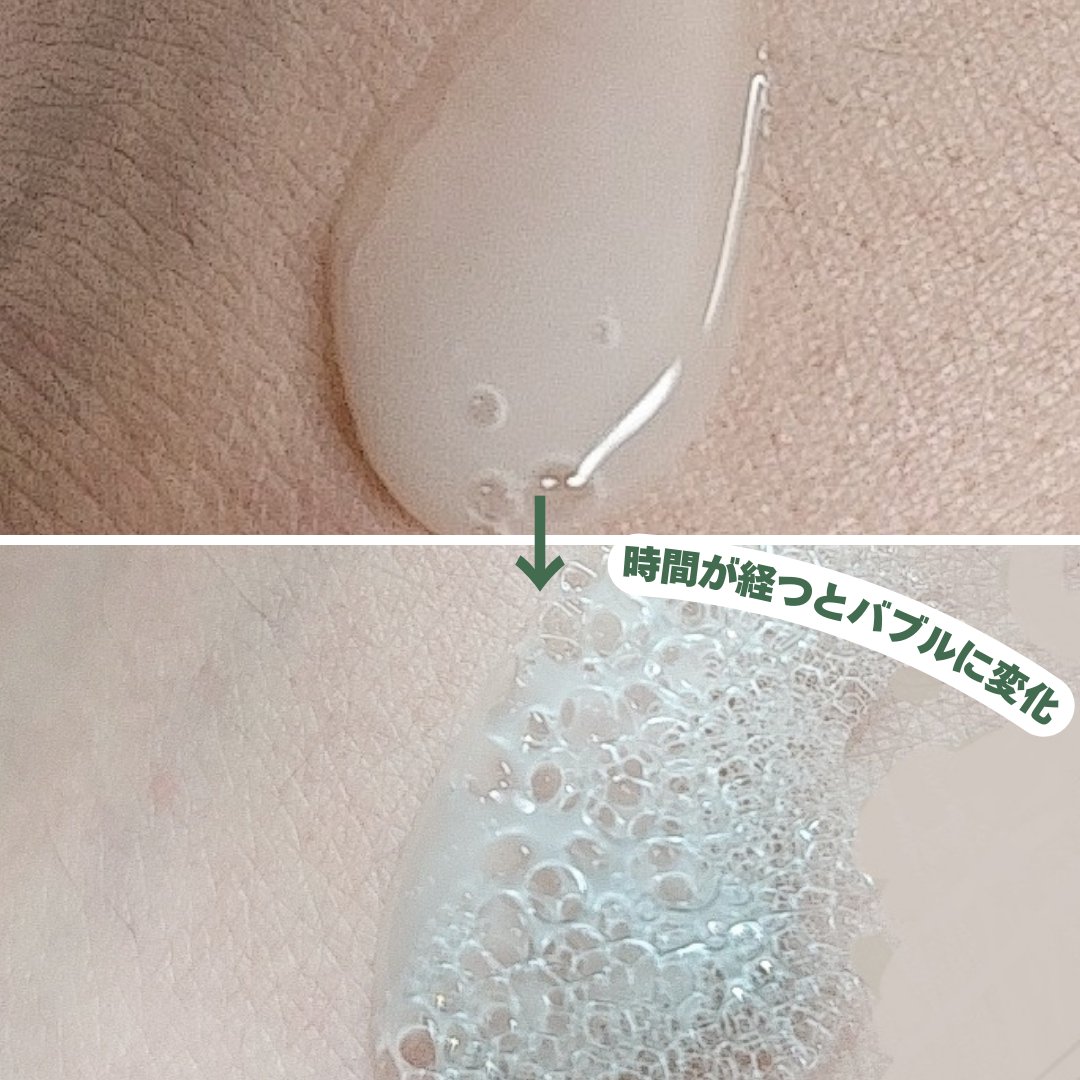 スパークリングスカルプスケーラー/ミンツリー/頭皮ケアを使ったクチコミ（3枚目）