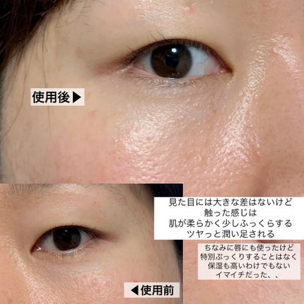 bubblewrap/Glossier./アイケア・アイクリームを使ったクチコミ(7枚目)