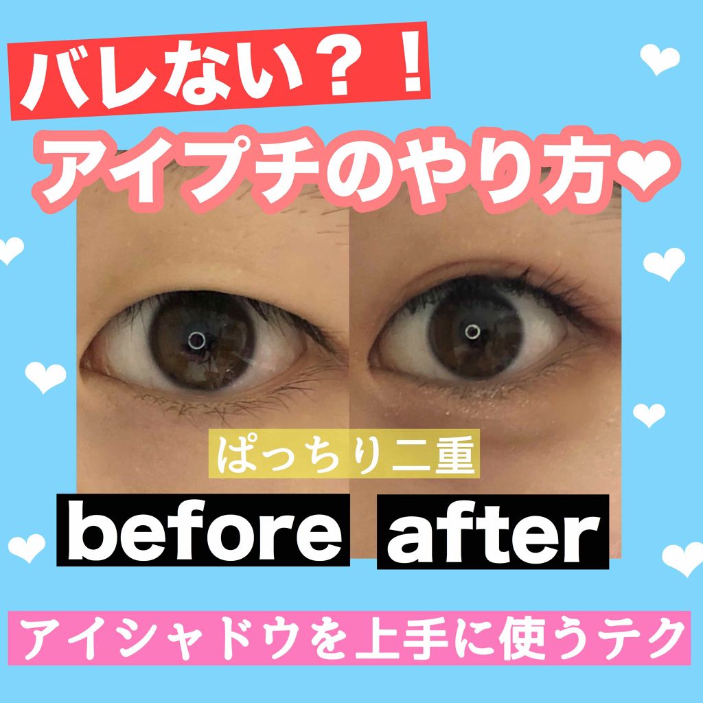 アイビューティー フィクサー WP/アストレア ヴィルゴ/二重まぶた用アイテムを使ったクチコミ（1枚目）