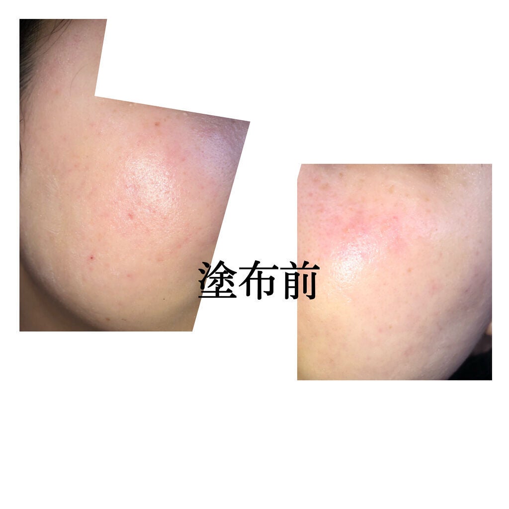 フィットミー コンシーラー/MAYBELLINE NEW YORK/リキッドコンシーラーを使ったクチコミ(2枚目)