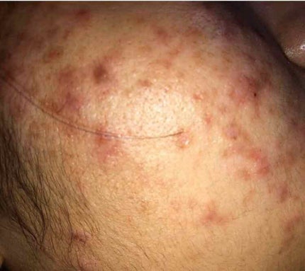 ハトムギ化粧水(ナチュリエ スキンコンディショナー R )/ナチュリエ/化粧水を使ったクチコミ(2枚目)