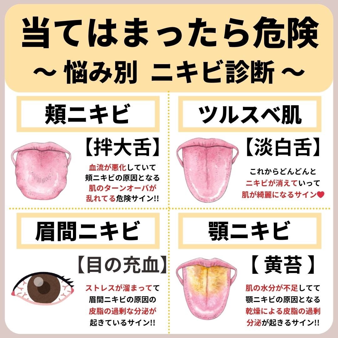 あなたの肌に合ったスキンケア💐コーくん先生 on LIPS 「【あなたは大丈夫!?】悩み別ニキビの原因診断...あなたの毛穴..」(1枚目)