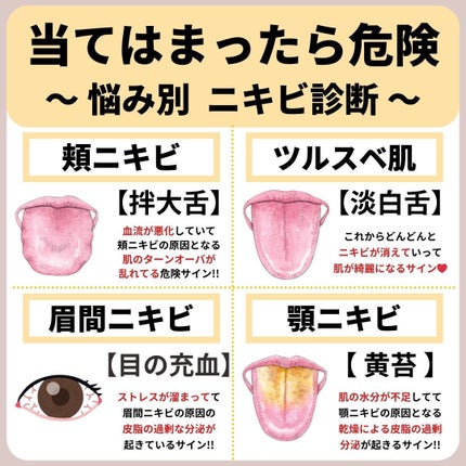 あなたの肌に合ったスキンケア💐コーくん先生 on LIPS 「【あなたは大丈夫!?】悩み別ニキビの原因診断...あなたの毛穴..」(1枚目)