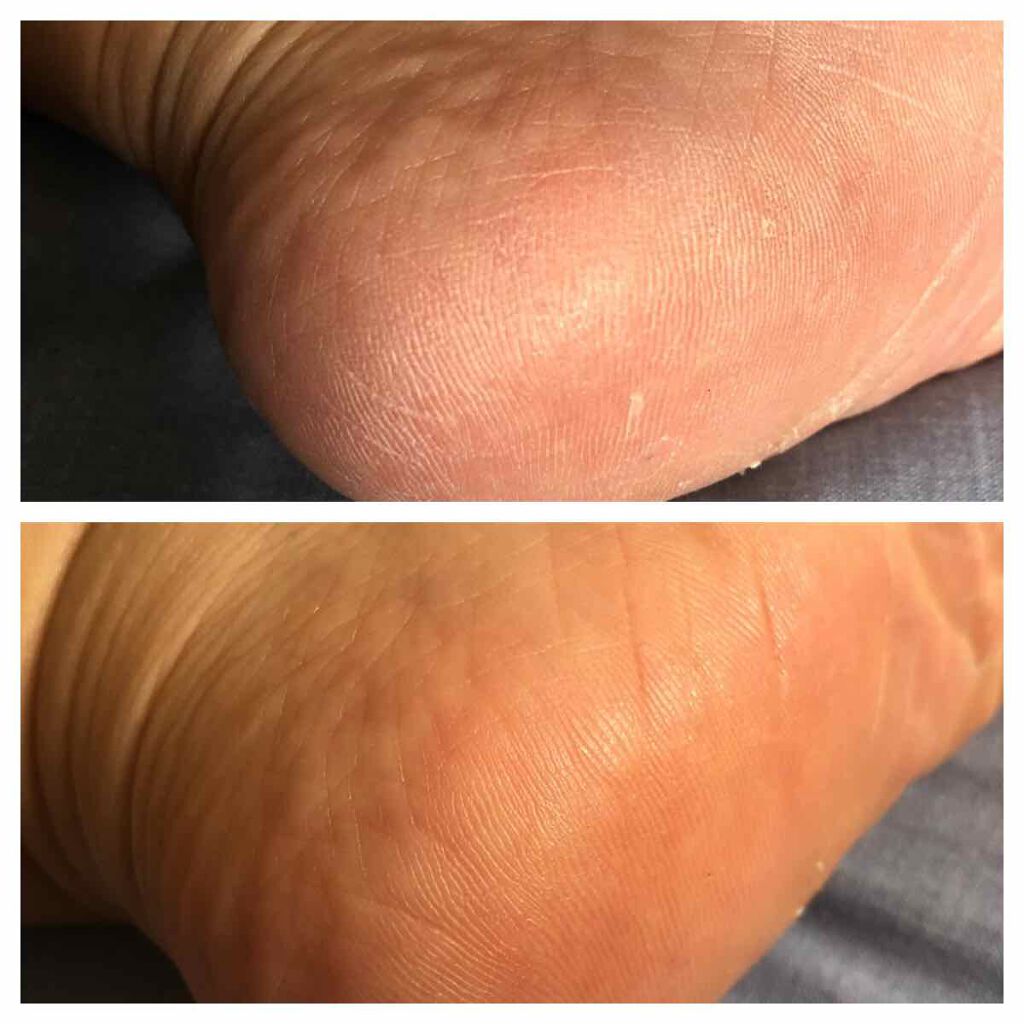 カカトリーヌモイストローション/KAKATOrine/レッグ・フットケアを使ったクチコミ(3枚目)