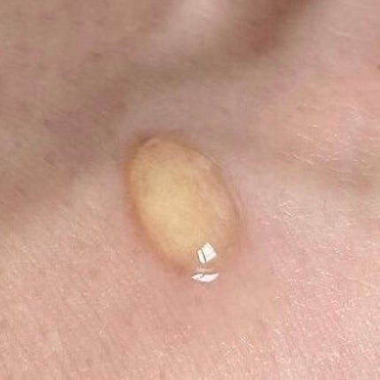 RXザ・ビタミンC23セラム/COSRX/美容液を使ったクチコミ(2枚目)