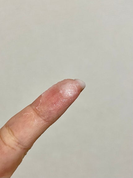 イハダ 薬用バーム【医薬部外品】/IHADA/フェイスバームを使ったクチコミ(5枚目)