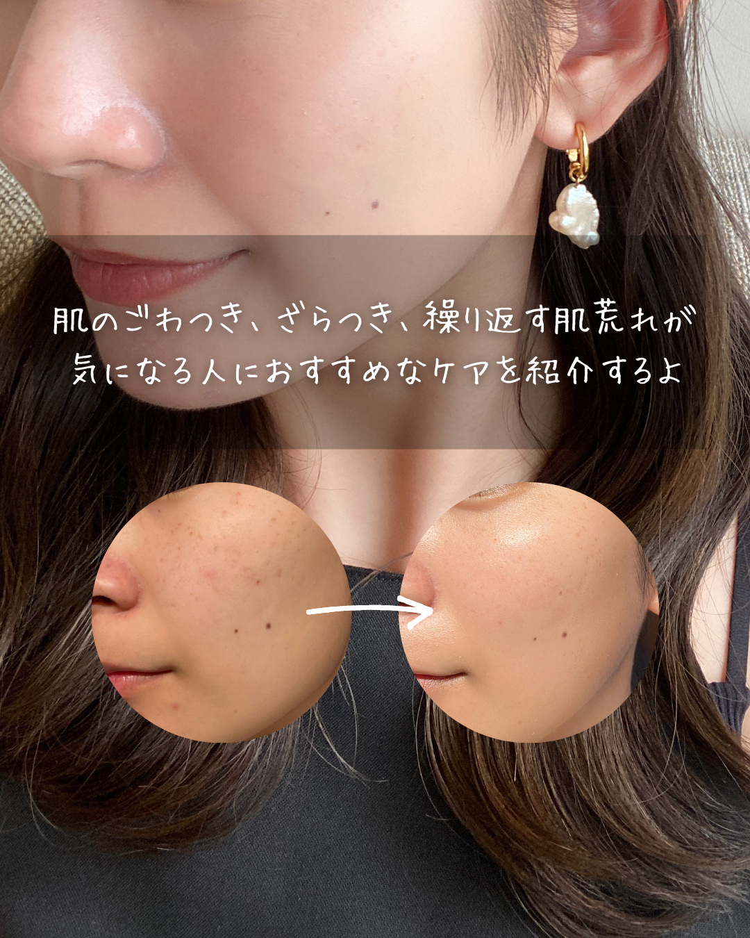 4番 毛穴ゼロたまご肌トナーパッド/numbuzin/トナーパッドを使ったクチコミ（2枚目）