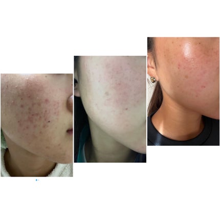 発酵導入化粧液/無印良品/化粧水を使ったクチコミ(2枚目)