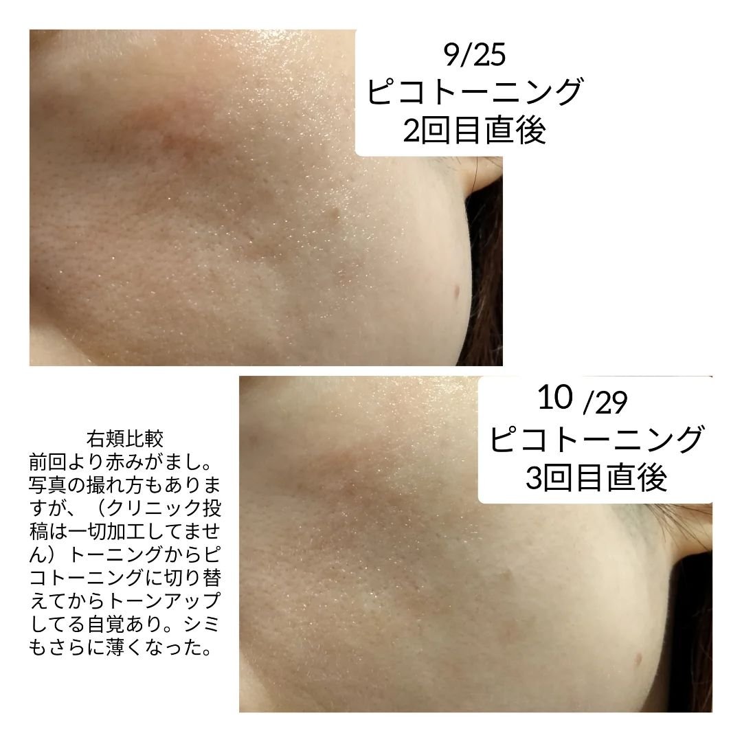 を使ったクチコミ（2枚目）