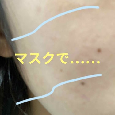 まりーな🌵🐫 on LIPS 「マスクってこのご時世、必須ですよね。でも、私マスクつけると肌荒..」（1枚目）