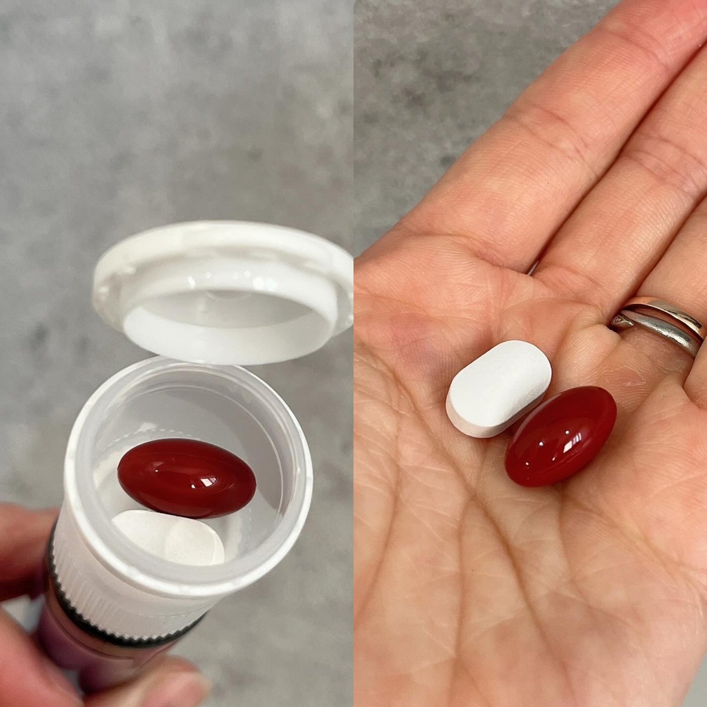 ドクターエスターセラミドプラス/ESTHER FORMULA/美容サプリメントを使ったクチコミ(3枚目)