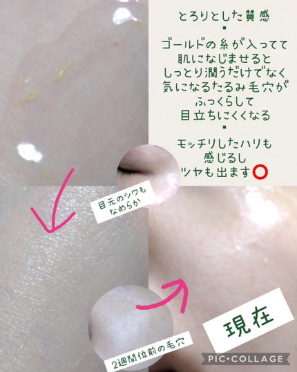 シューマジショットゴールド糸リフティングアンプル/MEDITHERAPY/美容液を使ったクチコミ(3枚目)