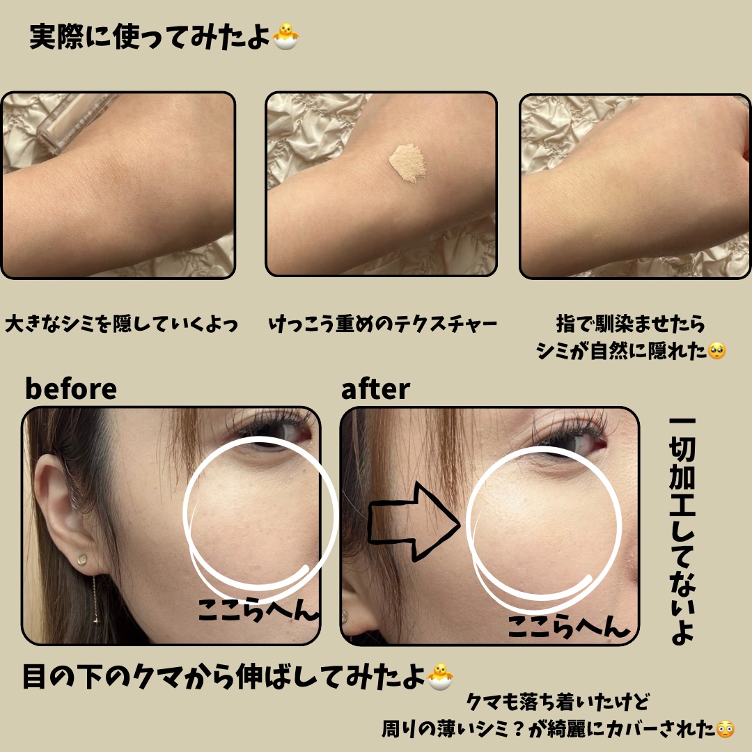 ダーマシンコンシーラー/23years old/リキッドコンシーラーを使ったクチコミ（2枚目）