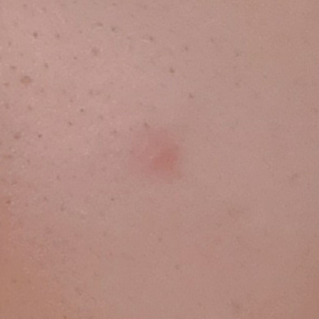 スティックコンシーラーA/KATE/スティックコンシーラーを使ったクチコミ（2枚目）