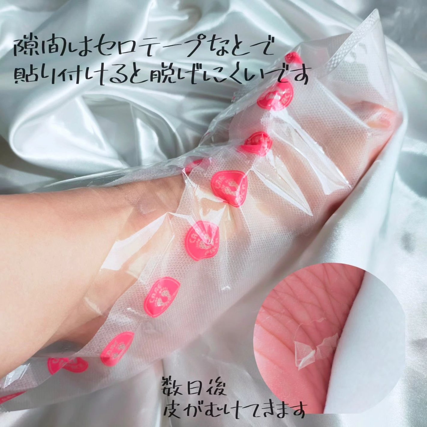 あしやすめ 足裏角質ケアパック/鎌倉ライフ/レッグ・フットケアを使ったクチコミ(4枚目)