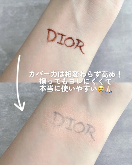 ディオールスキン フォーエヴァー スキン コレクト コンシーラー/Dior/リキッドコンシーラーを使ったクチコミ(6枚目)