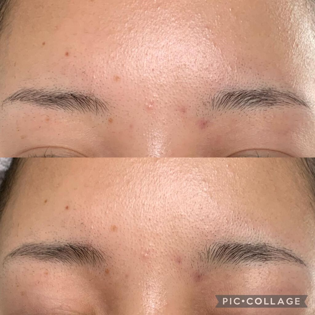 フェリエ フェイス用 ES-WF41/Panasonic/シェーバーを使ったクチコミ(4枚目)