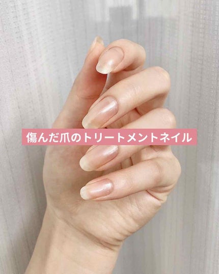 カラーケア グローエード/ORLY/ネイルオイル・トリートメントを使ったクチコミ(1枚目)