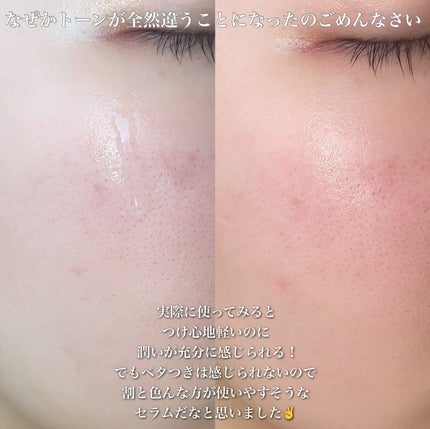 ノスカナイン トラブル セラム/FATION/美容液を使ったクチコミ(6枚目)