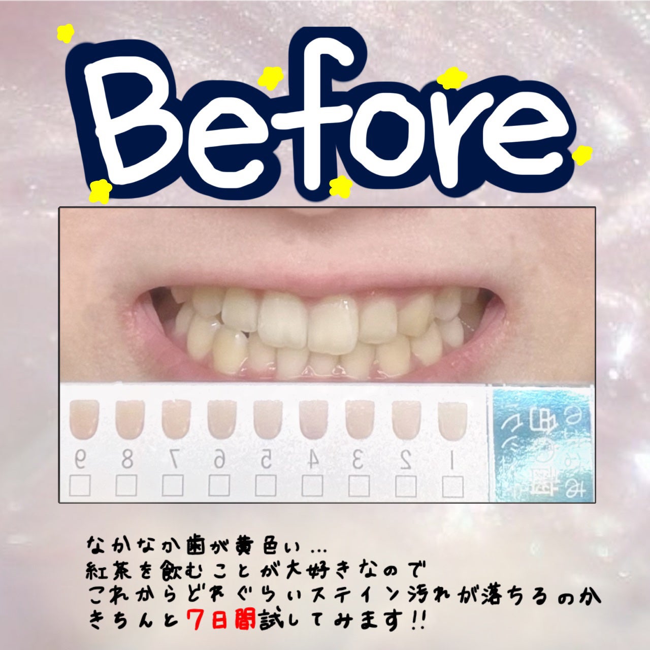 アパガードセレナ/アパガード/歯磨き粉を使ったクチコミ(3枚目)