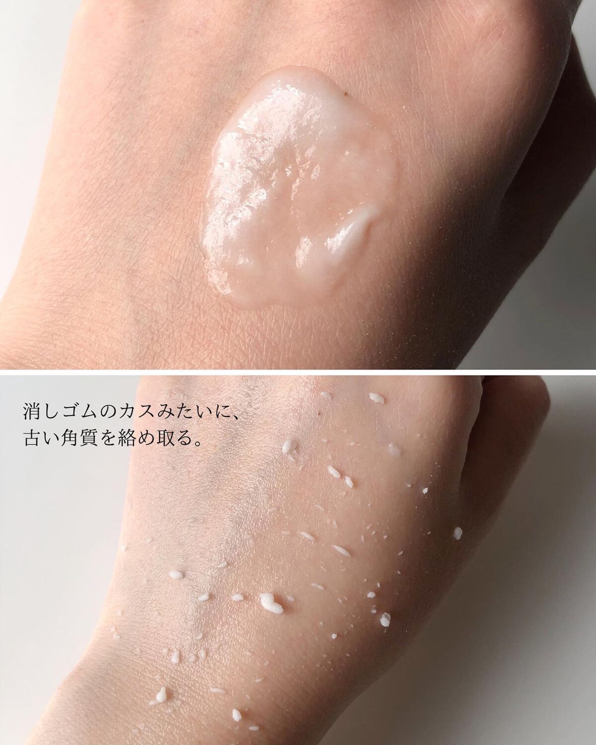 乾燥肌におすすめのピーリング！肌のざらつきや角質、どうにかしたいけど by  Laymiu ⌇スキンケア・コスメレビュー(乾燥肌) LIPS