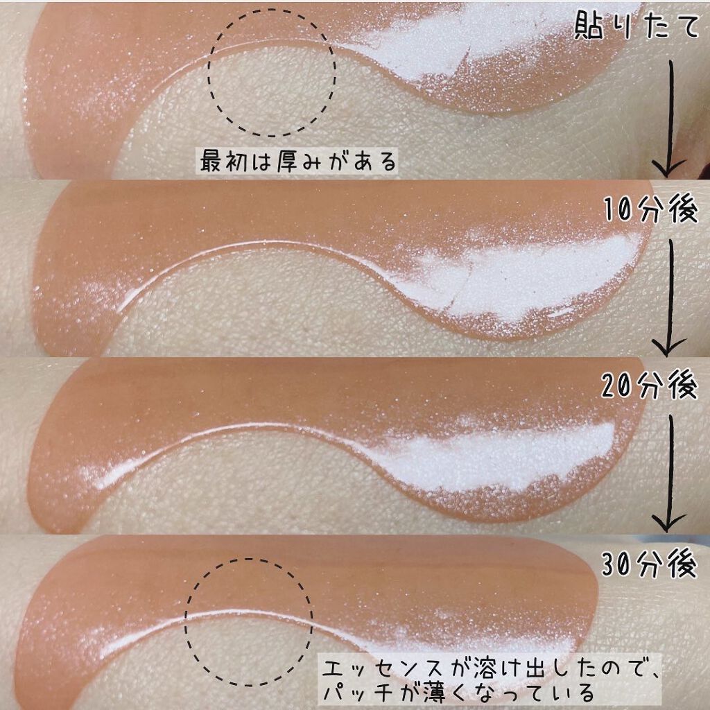 もりりん on LIPS 「@skinbab_jp様の【PUREDERMHydrogelE..」(5枚目)