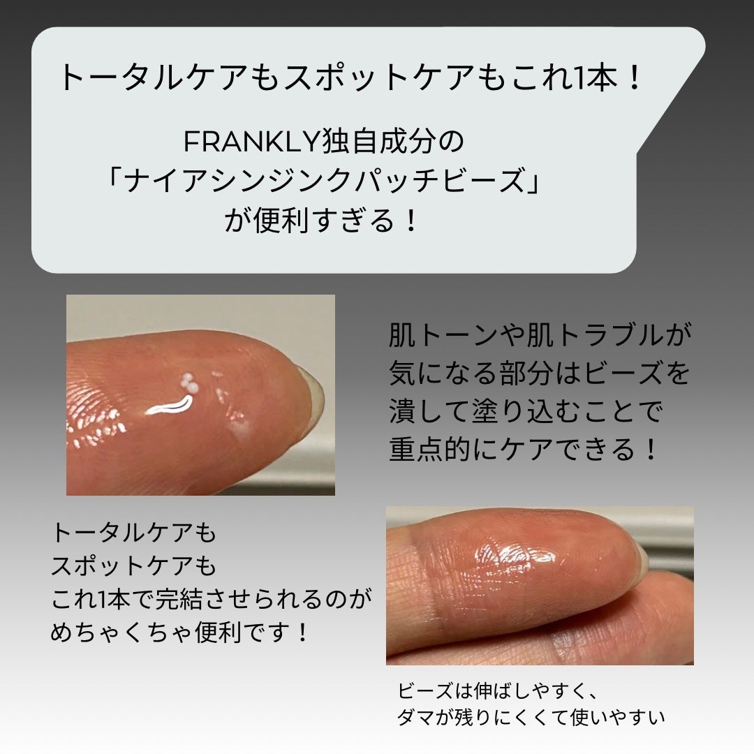 ナイアシンジンクビーズセラム/Frankly/美容液を使ったクチコミ(3枚目)