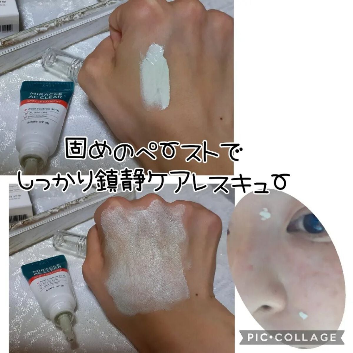 ミラクルアクネクリアスポットトリートメント/SOME BY MI/美容液を使ったクチコミ(3枚目)