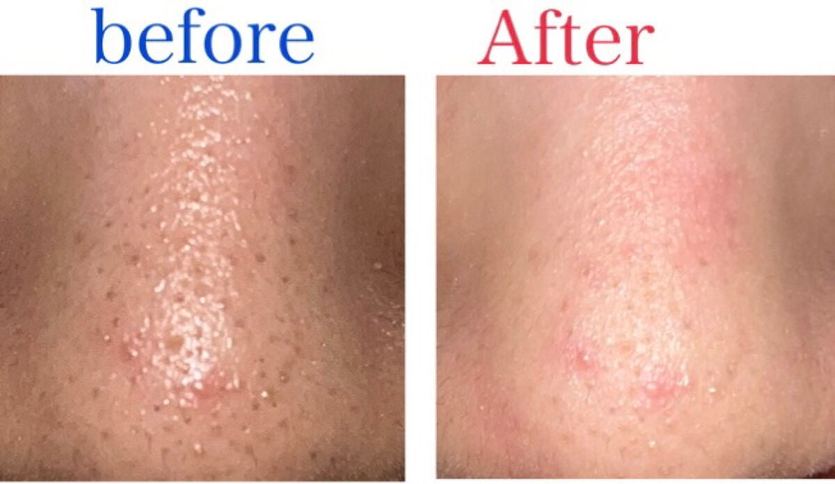 おうちdeエステ 肌をなめらかにするマッサージ洗顔ジェル 炭/ビオレ/その他洗顔料を使ったクチコミ(4枚目)