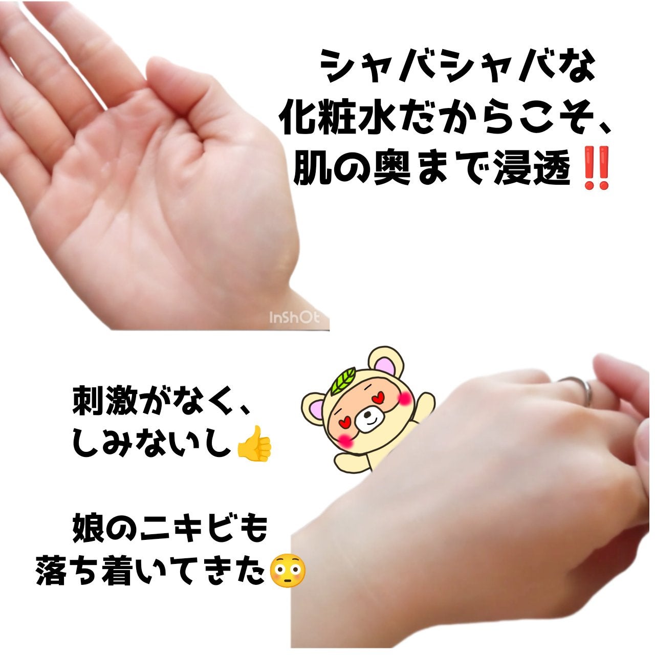 オールカーミングトナー /Easydew/化粧水を使ったクチコミ(3枚目)