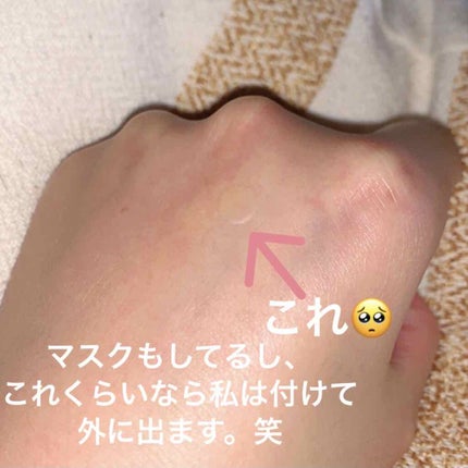 ゼロスポットパッチ/Today’s Cosme/にきびパッチを使ったクチコミ(2枚目)