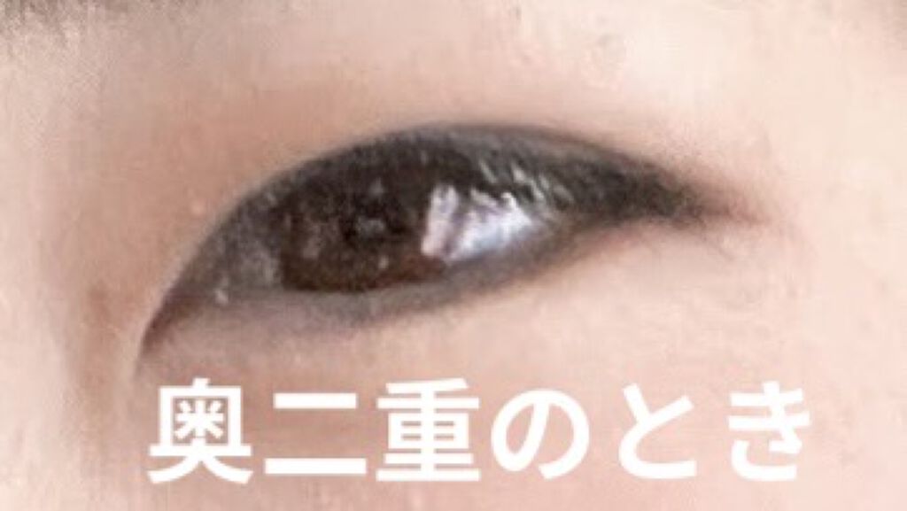 絆創膏/DAISO/その他を使ったクチコミ（1枚目）