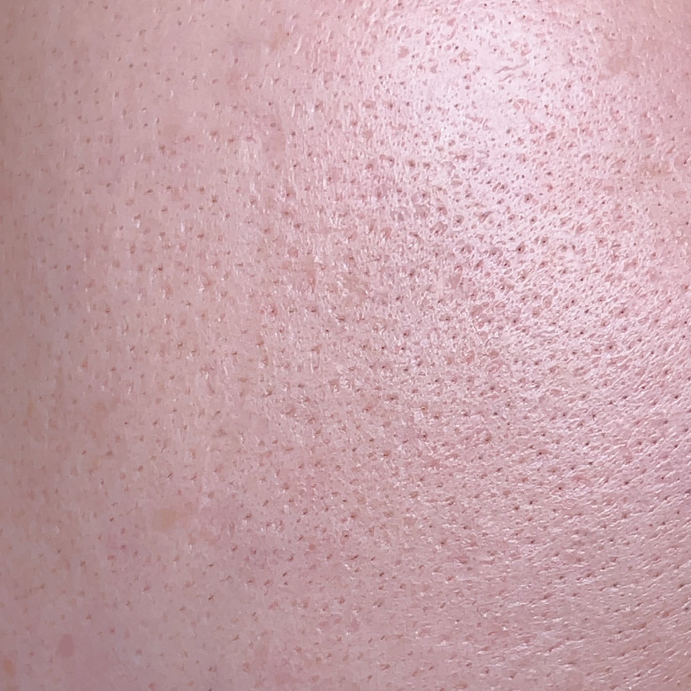 ハトムギ化粧水(ナチュリエ スキンコンディショナー R )/ナチュリエ/化粧水を使ったクチコミ(6枚目)