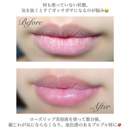 ローズリップ美容液/ROSE LABO/リップ美容液を使ったクチコミ(3枚目)