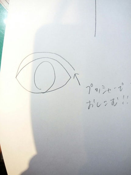 アイトーク/アイトーク/二重まぶた用アイテムを使ったクチコミ(3枚目)