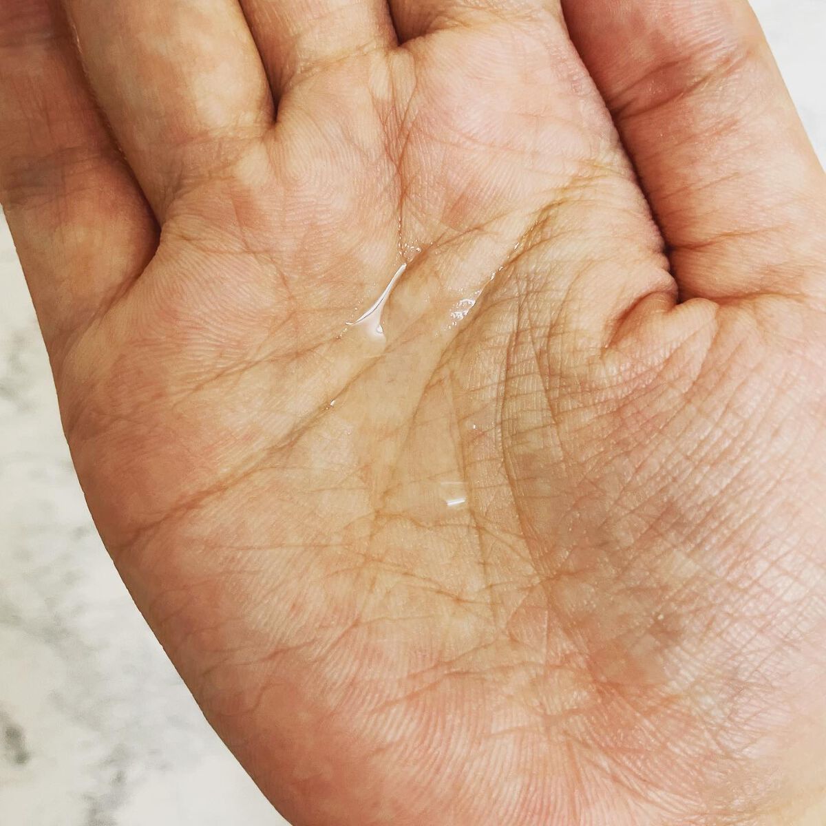 FDR アクネケア 化粧液/ファンケル/化粧水を使ったクチコミ(2枚目)