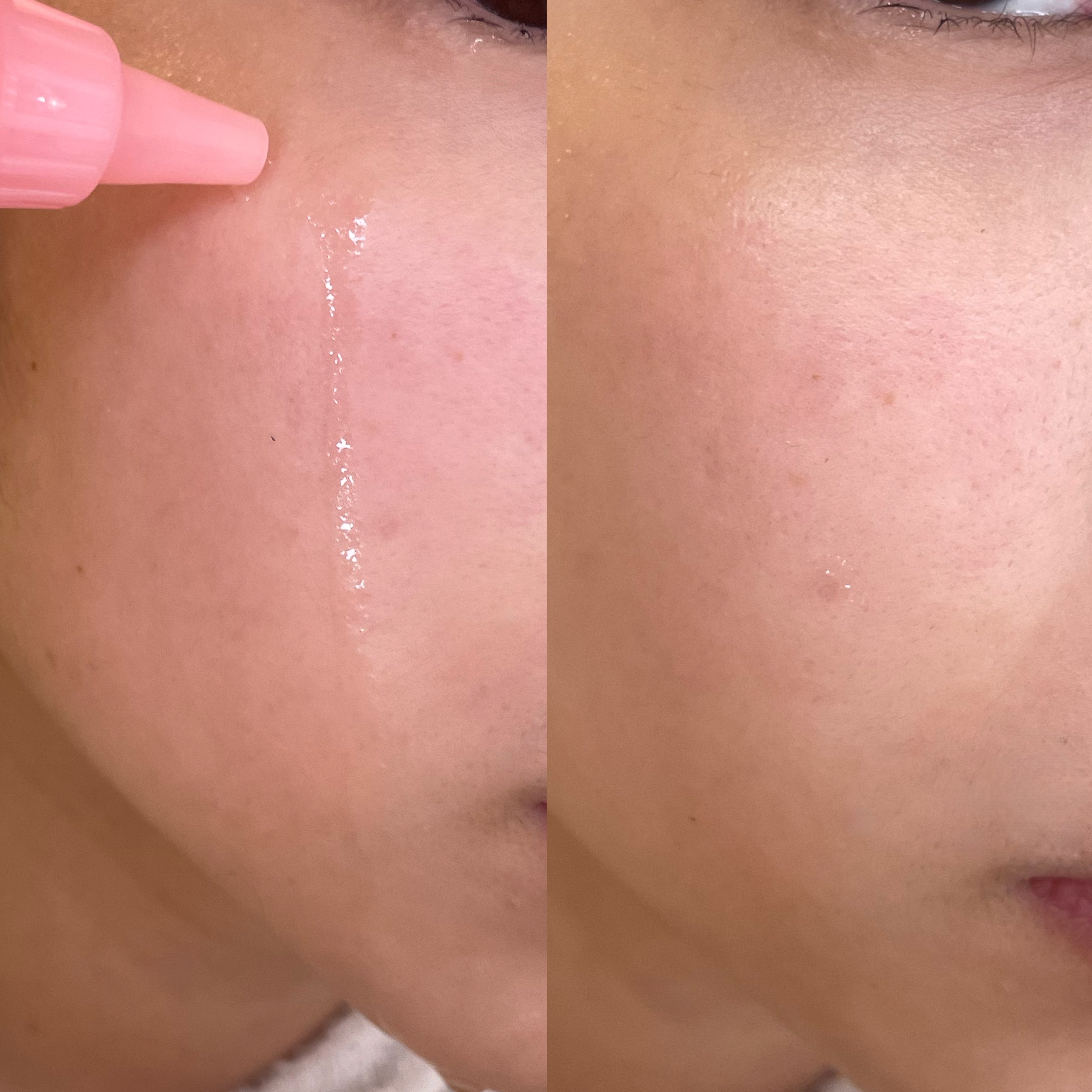 ピンクアロエビタトナー/APRILSKIN/化粧水を使ったクチコミ（3枚目）