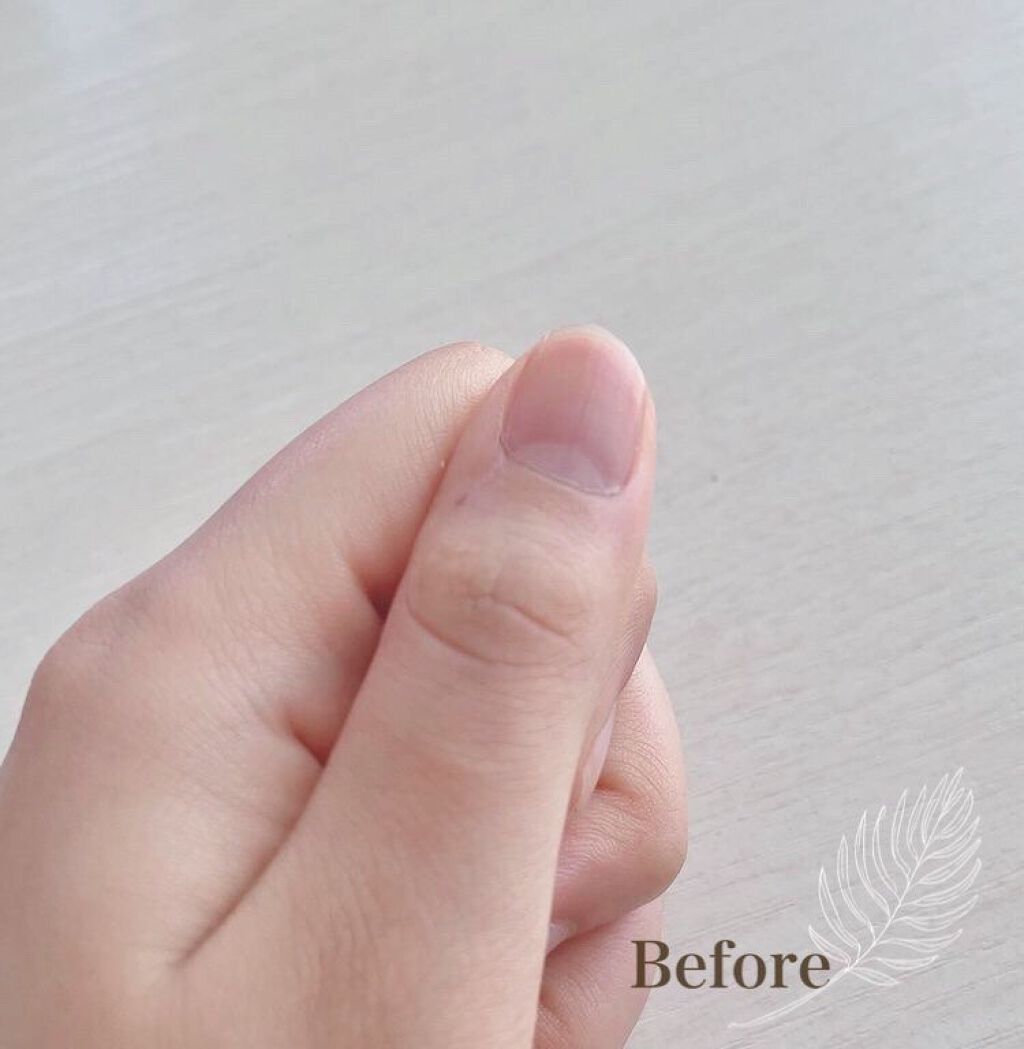 SHキューティクルリムーバーオイル/セリア/ネイルオイル・トリートメントを使ったクチコミ（3枚目）