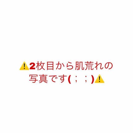 薬用スキンミルク/オードムーゲ/乳液を使ったクチコミ(1枚目)