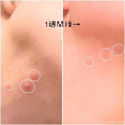 シカドリップセラム /KarteMade /美容液を使ったクチコミ(4枚目)