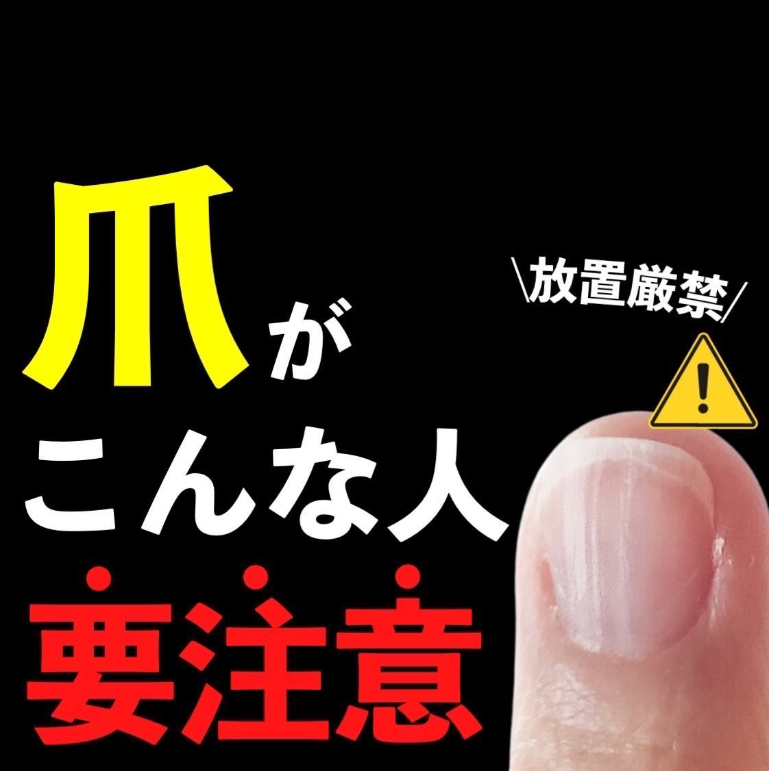 あなたの肌に合ったスキンケア💐コーくん先生 on LIPS 「【当てはまったらヤバい】爪がこんな人はマジ危険。..あなたの毛..」(1枚目)