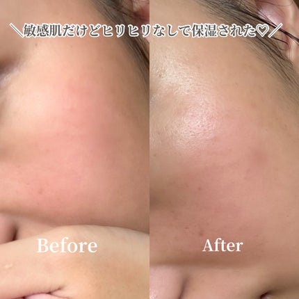 ファイン100/imini/美容液を使ったクチコミ(4枚目)