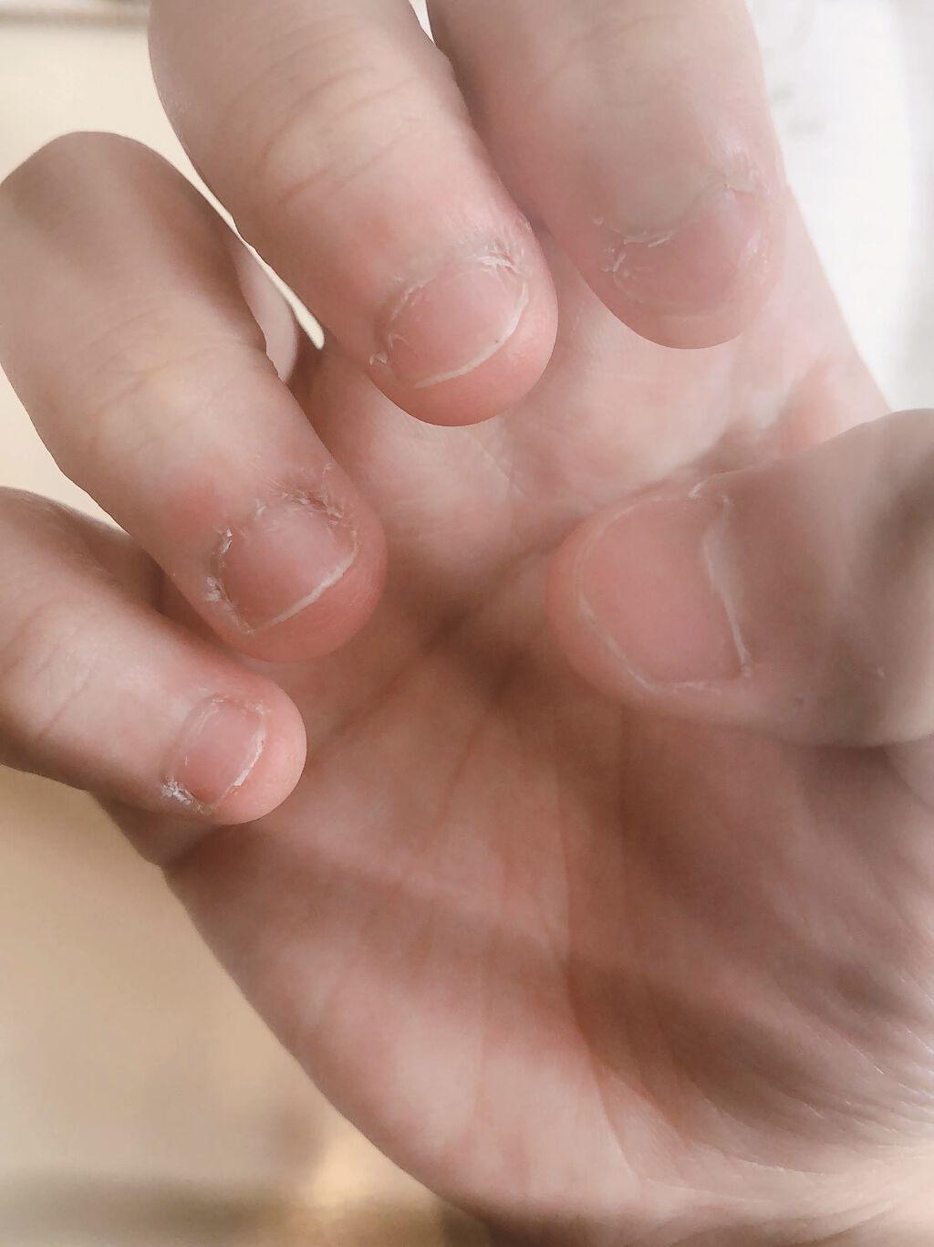 ネイルケアオイル/無印良品/ネイルオイル・トリートメントを使ったクチコミ（2枚目）